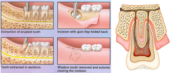 Tooth Extraction For A Bad Teeth Dr Nechupadam Dental Clinic