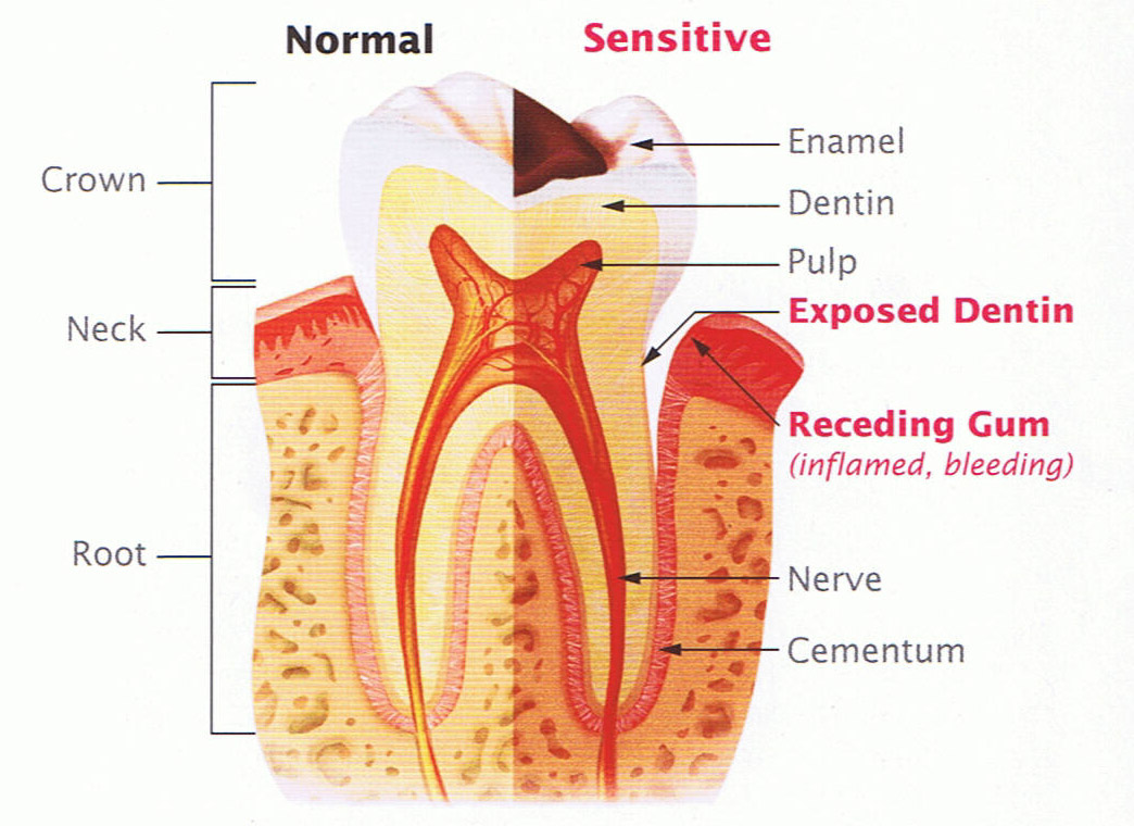 what-causes-sensitive-teeth-dr-nechupadam-dental-clinic