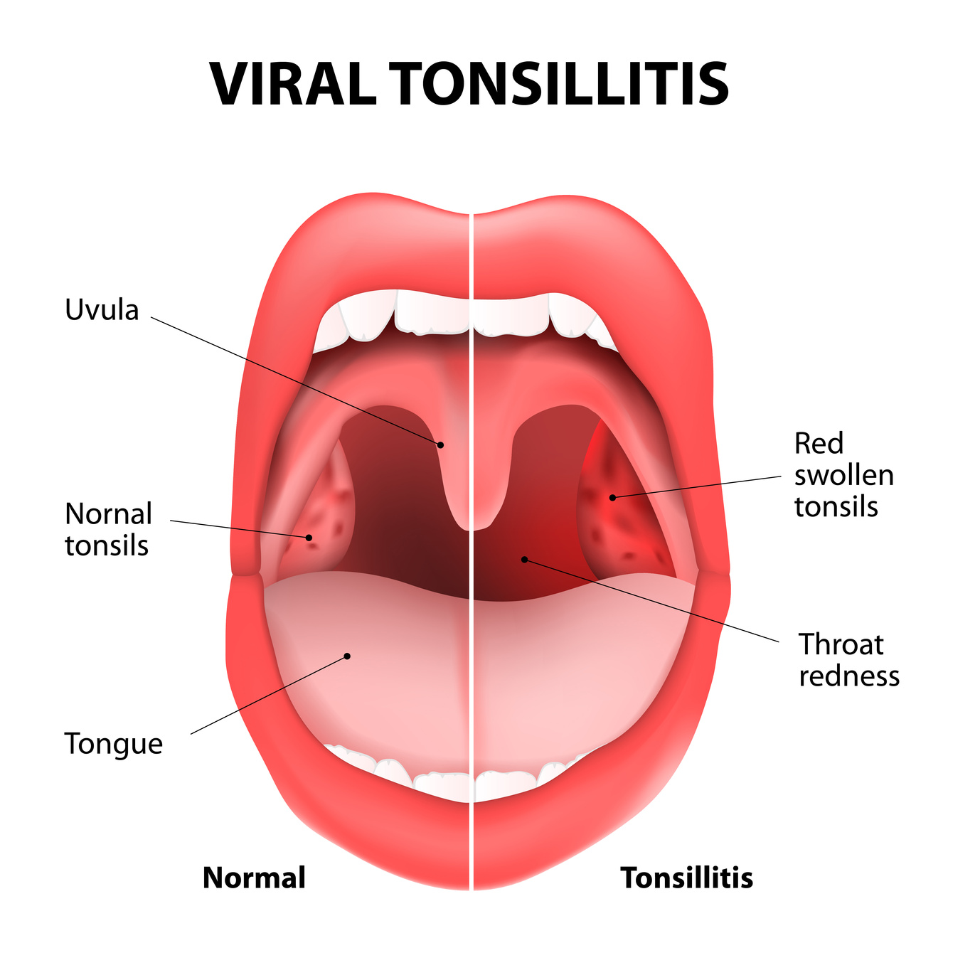 Common Seasonal Allergies And Dental Health Dr Nechupadam Dental Clinic