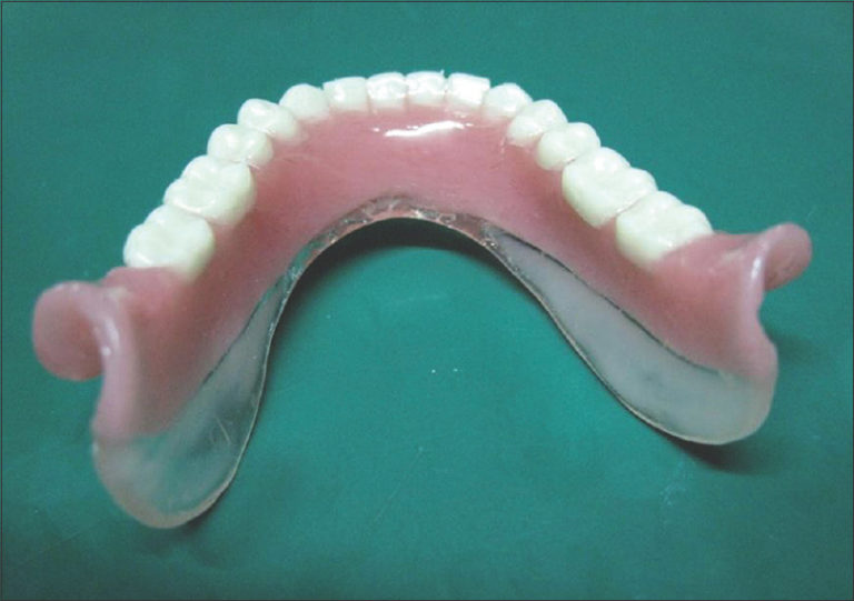 Parts of Complete Denture | Dr. Nechupadam Dental Clinic