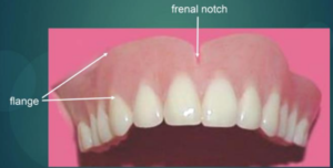 Parts of Complete Denture | Dr. Nechupadam Dental Clinic